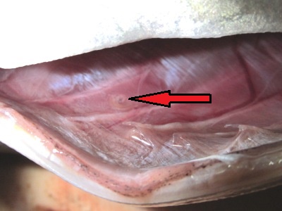 アニサキス発見（腹腔外側）